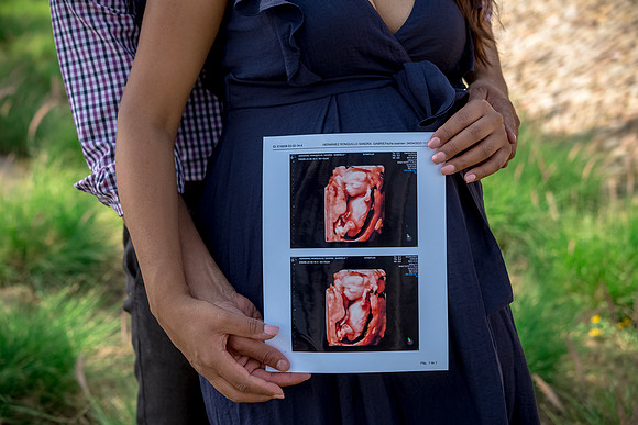 Gaby Mom to be-158
