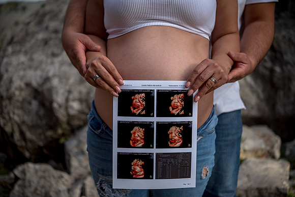 Sivelis Mom to be-44